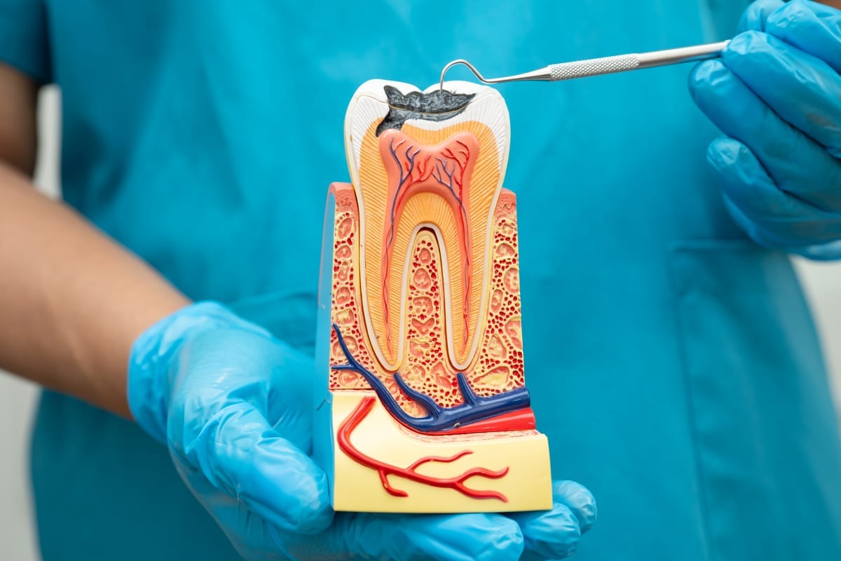 Root Canal Treatment in Austin