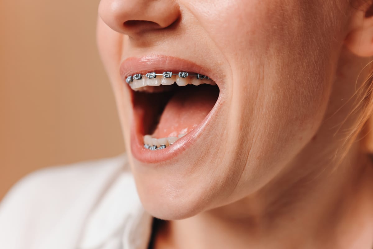 Orthodontics in Austin