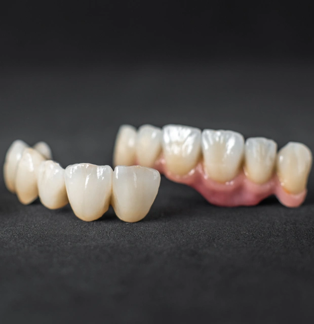 Row of ceramic dental crowns displayed on a dark reflective surface
