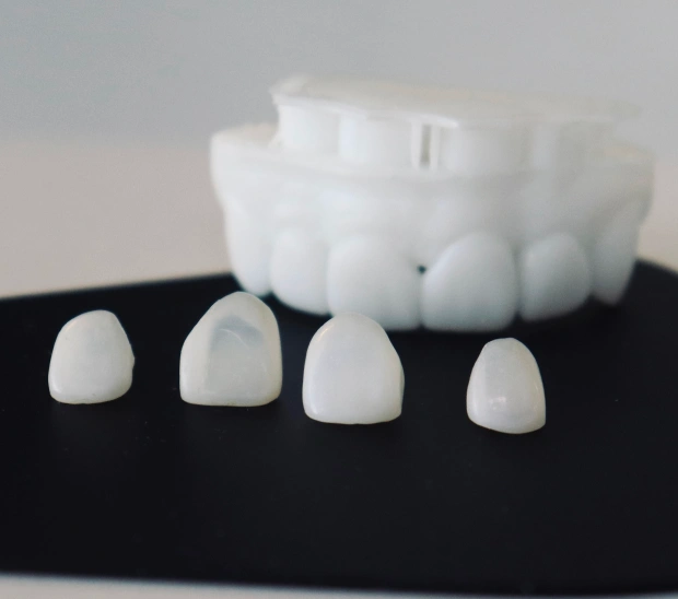 3D illustration of dental veneers on a white background