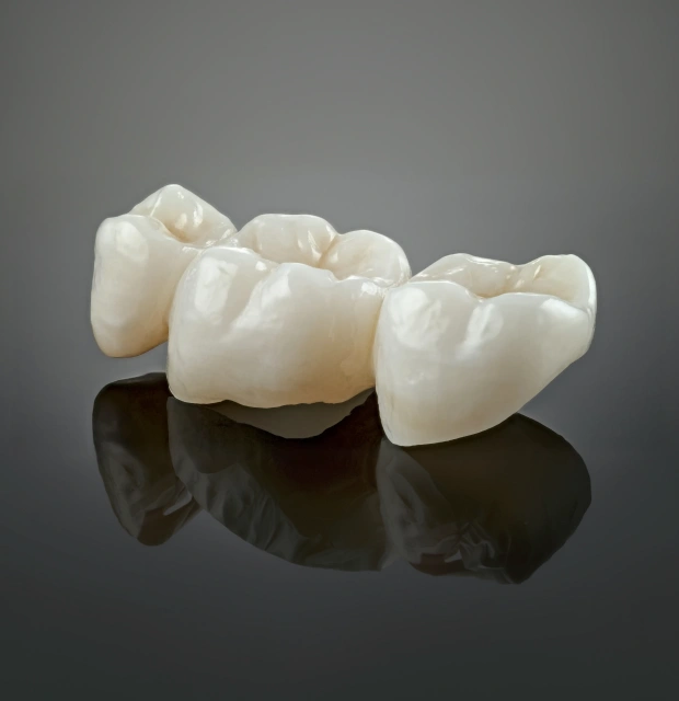 Ceramic dental crowns displayed on a dark reflective surface
