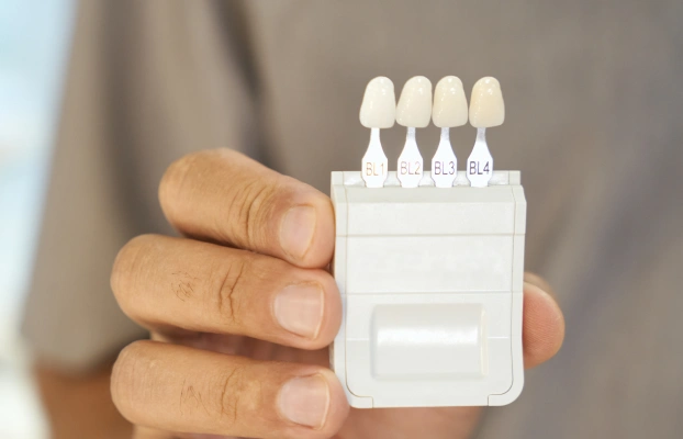 Hand holding a row of porcelain veneer shade samples on a white background