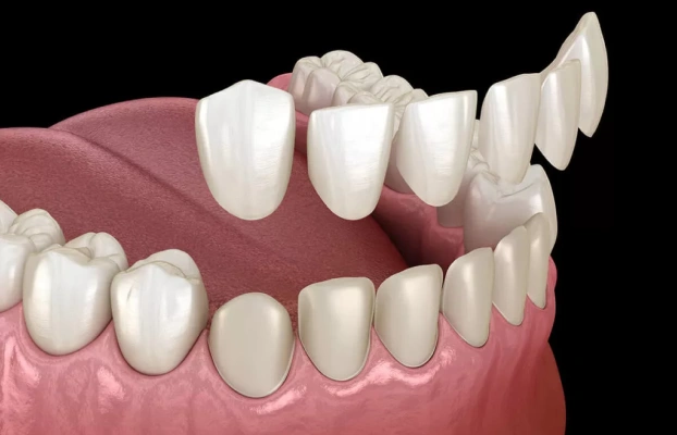 3D illustration of a full set of white teeth in a lower gum model on a dark background