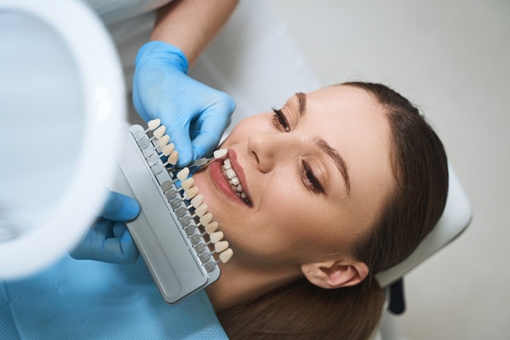 Composite And Porcelain Veneers