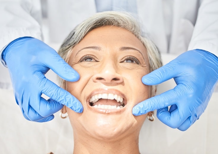 Dental Sealants a Smart Investment