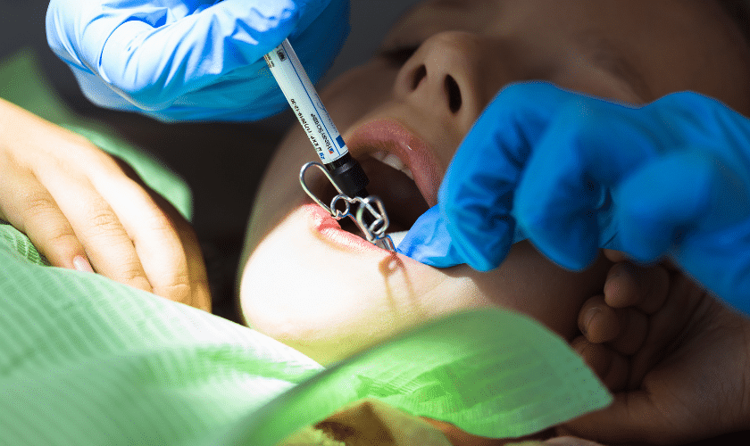 Regular Fluoride Cleanings