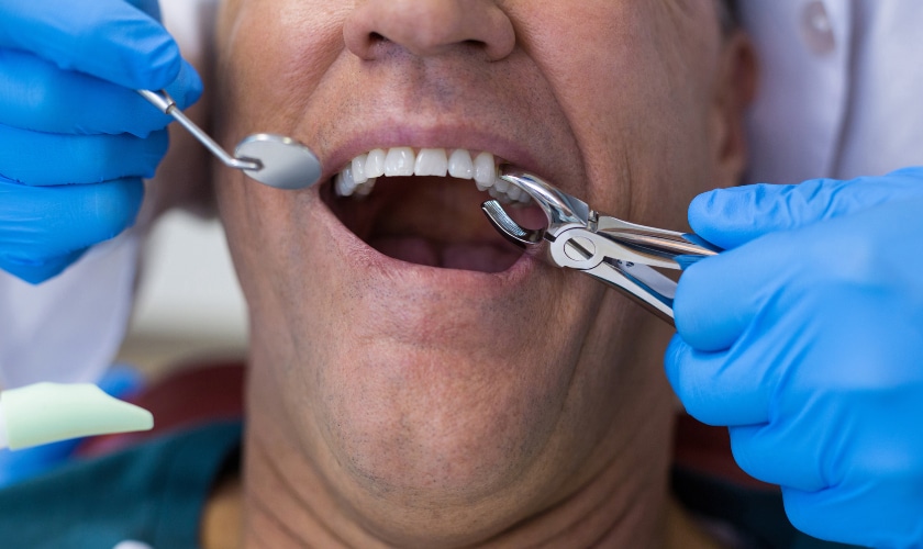 Tooth Extraction Necessary for Orthodontic Treatment