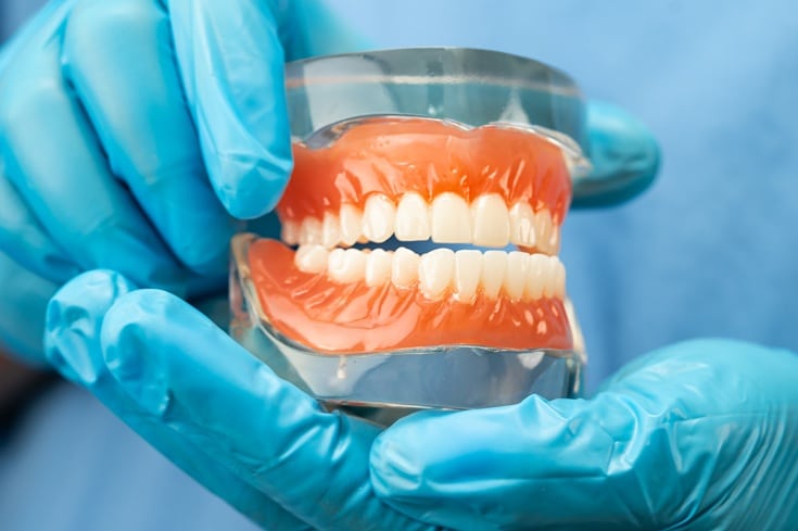 Dentures Are a Great Solution for Missing Teeth