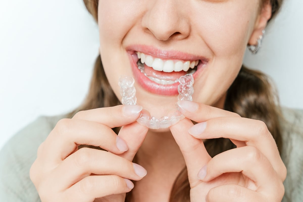 clear-aligners-in-Houston