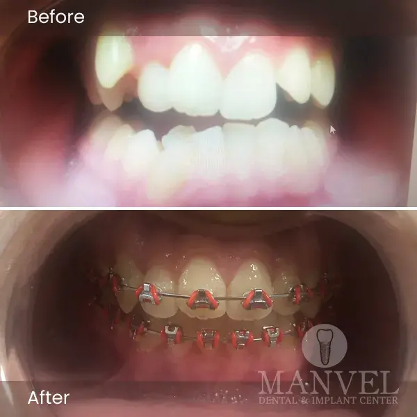 Before & After