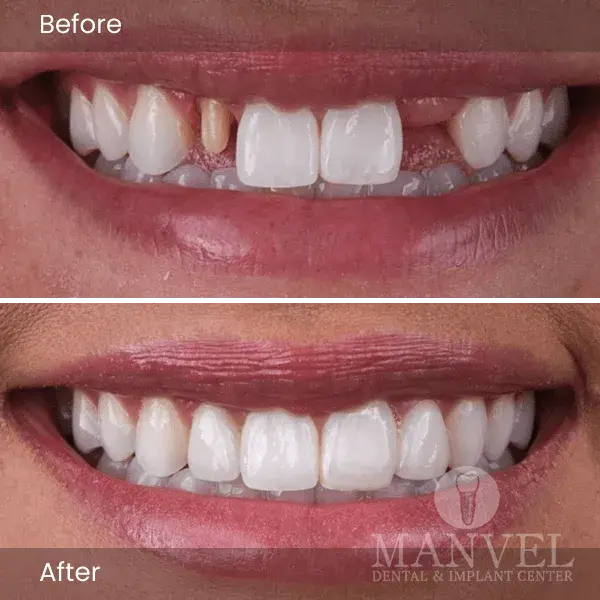 Before & After