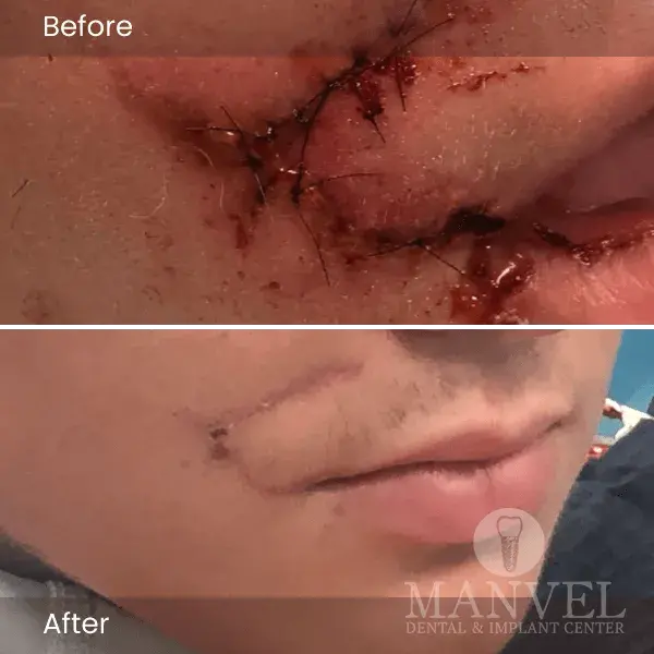 Before & After