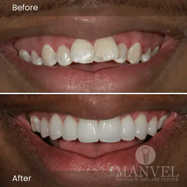 Before & After