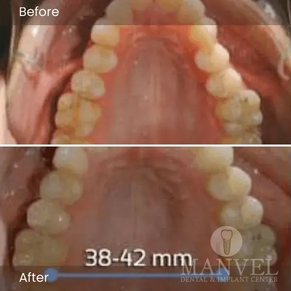 Before & After