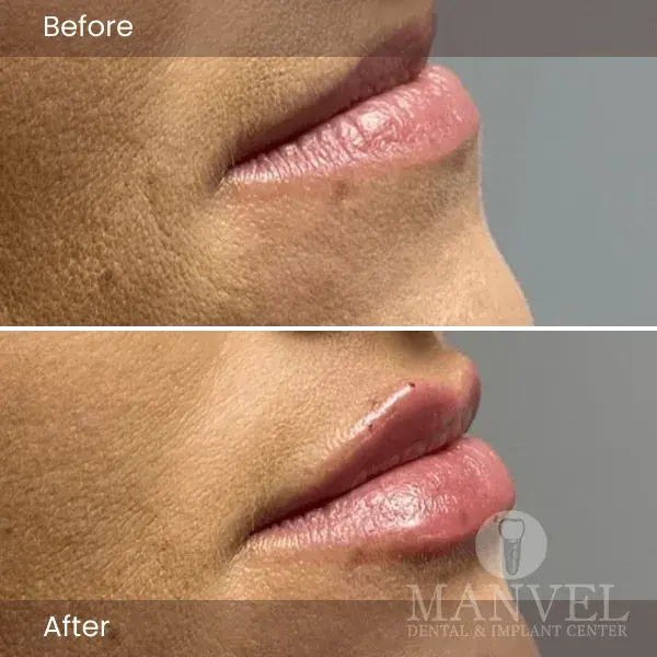 Before & After