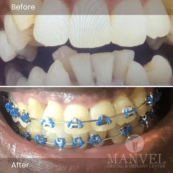 Before & After