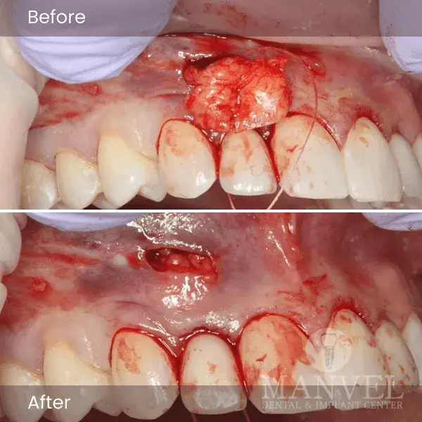 Before & After