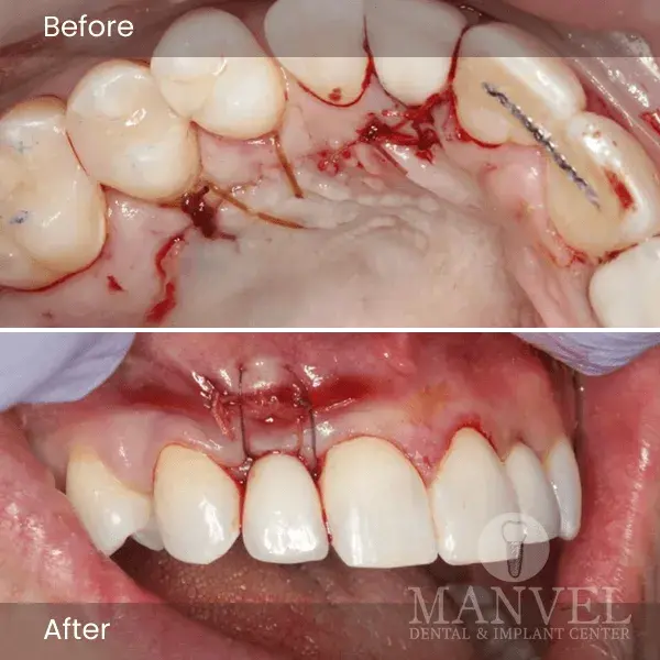 Before & After