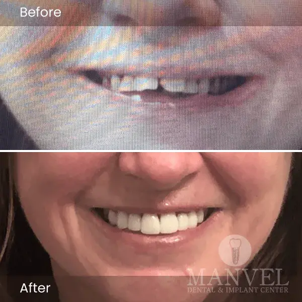 Before & After