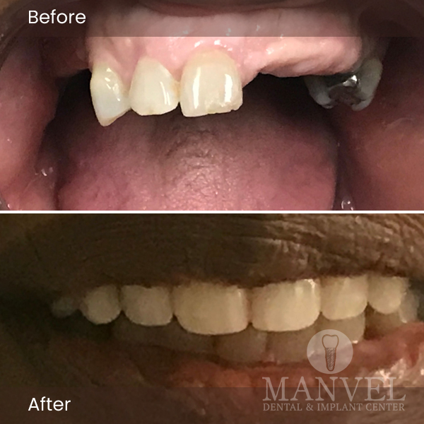 Before & After