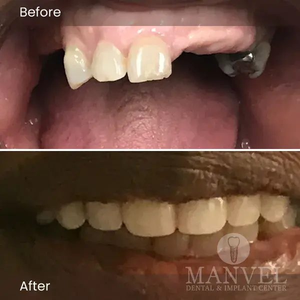 Before & After