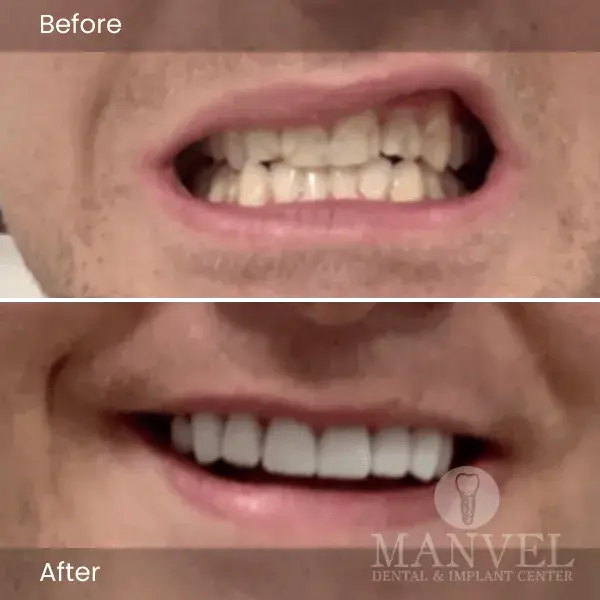Before & After