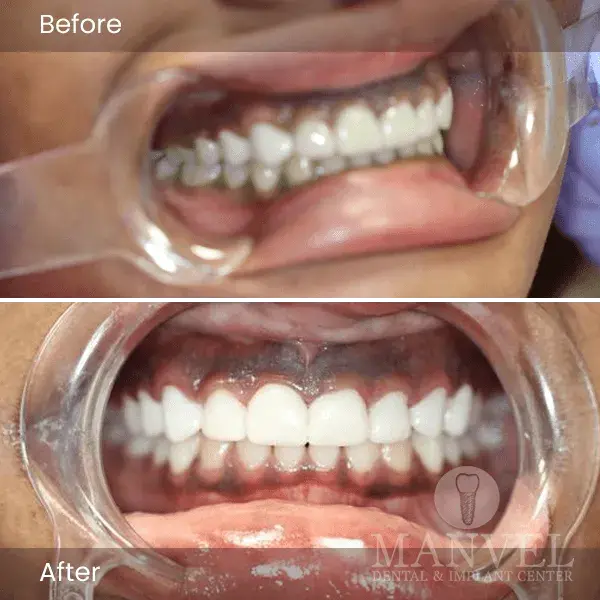 Before & After