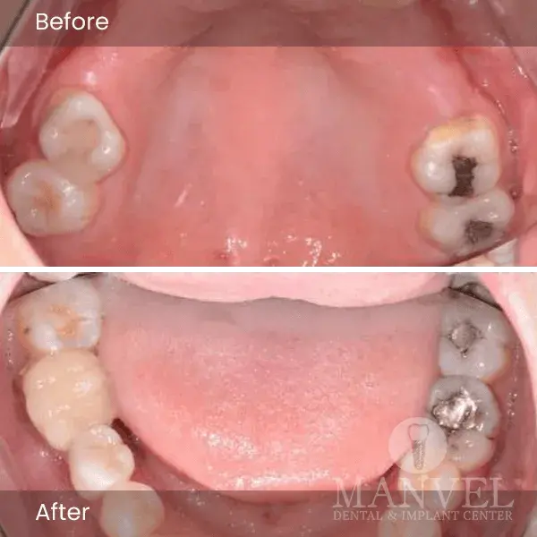 Before & After