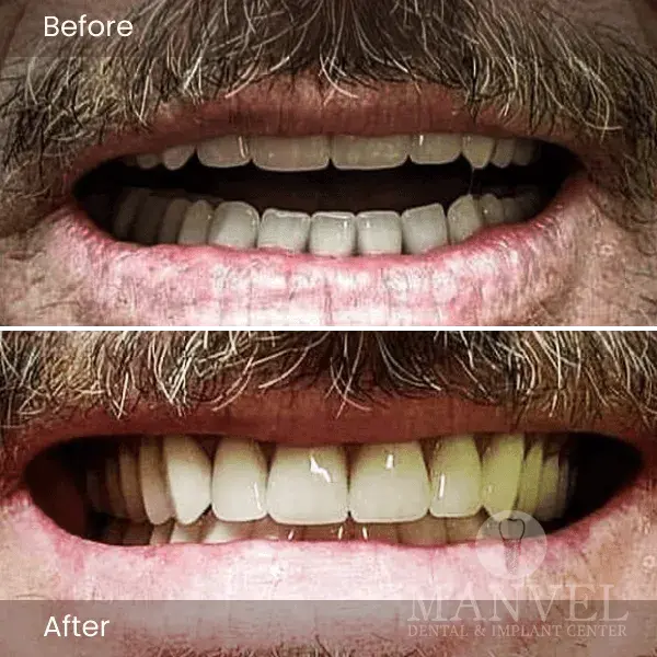 Before & After