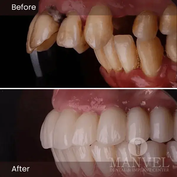 Before & After
