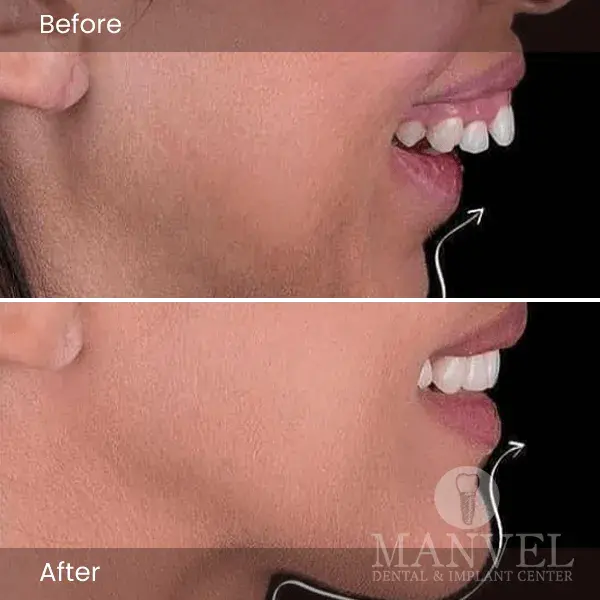 Before & After