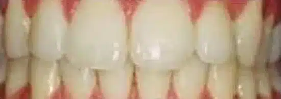 before smile makeover