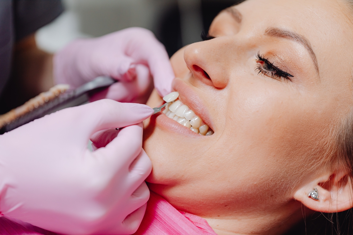 Prepless Veneers Frisco, TX