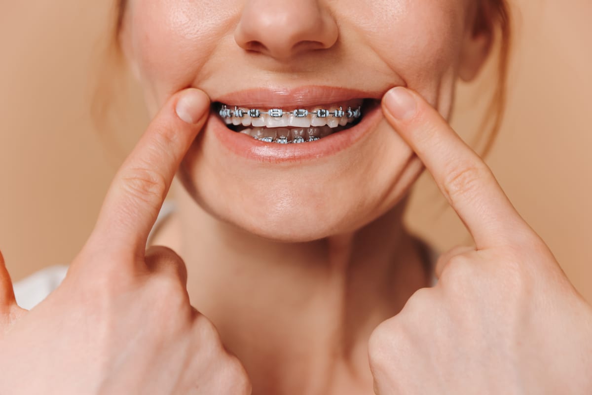 Orthodontics in Frisco