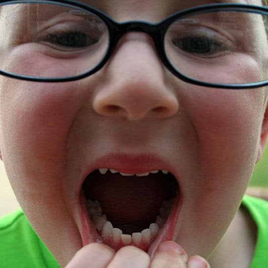 Child wearing glasses with mouth wide open, finger pointing inside mouth, green shirt visible.