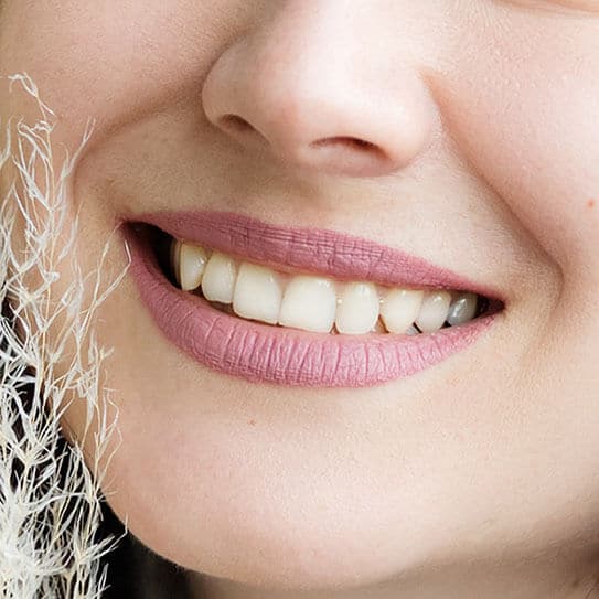 Close-up of woman's smile showing healthy teeth and natural lip color against skin tone.