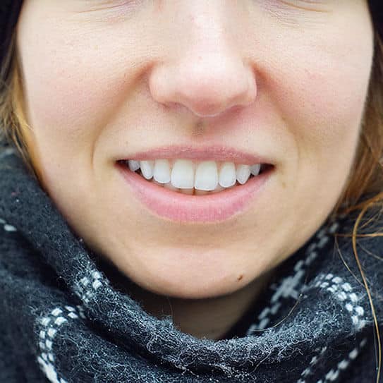 Close-up of smiling woman displaying healthy white teeth and warm expression outdoors.