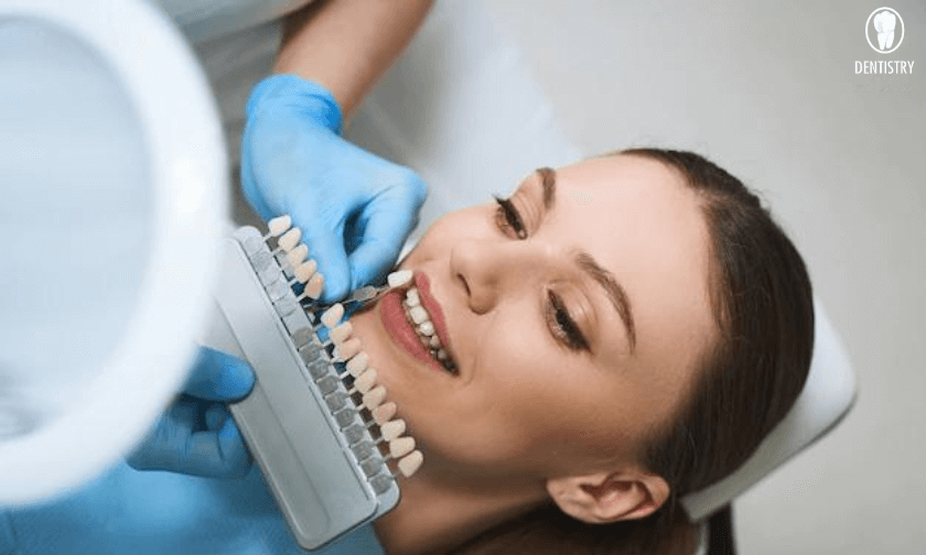 Veneers In Scottsdale