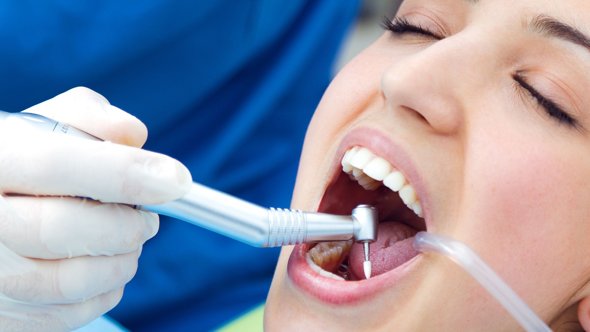 Teeth Whitening Scottsdale Teeth Whitening Scottsdale