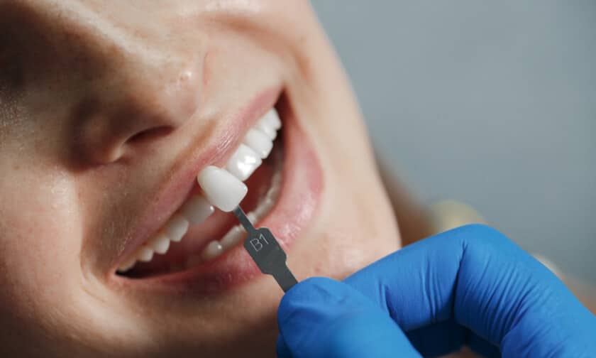 Veneers Scottsdale Veneers Scottsdale