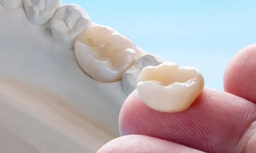 Dental Crowns Scottsdale Dental Crowns Scottsdale