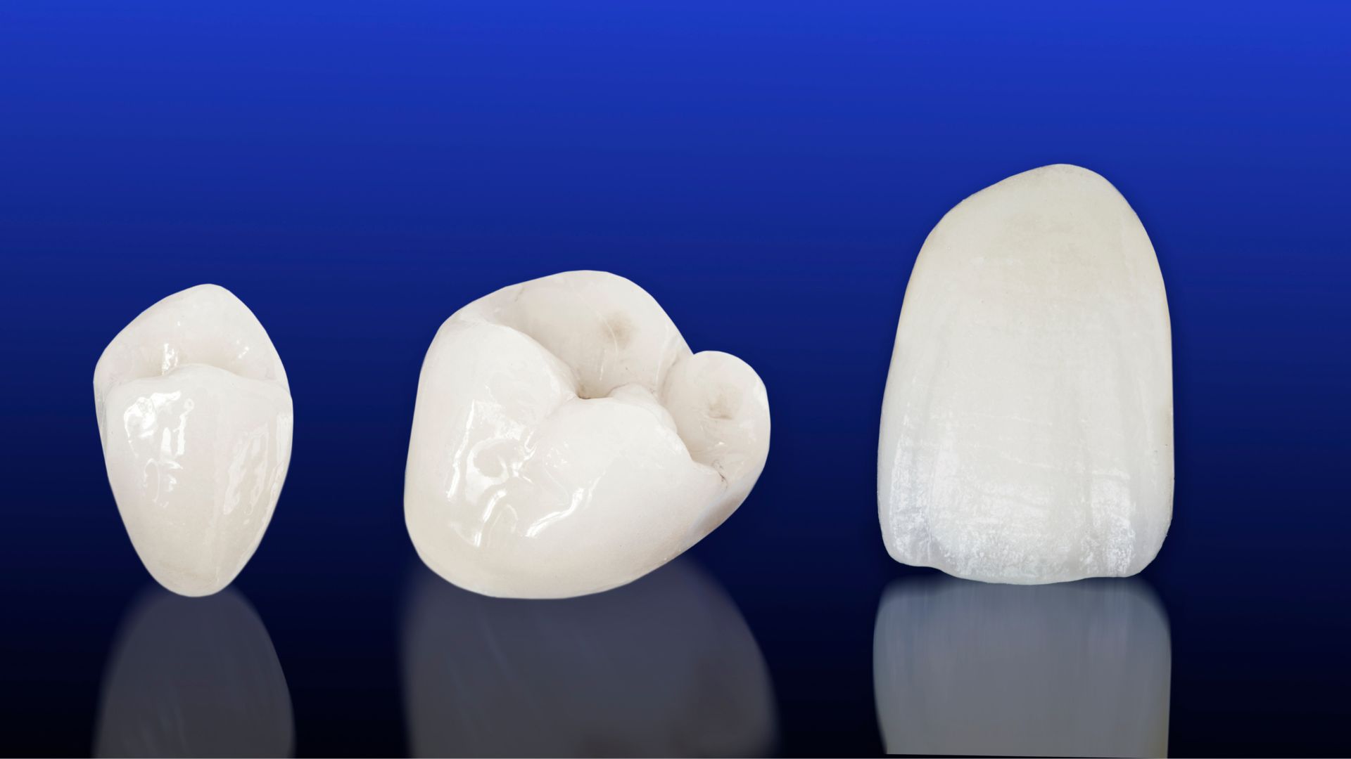5 Key Facts About Dental Crowns Shared by Our Scottsdale Team 5 Key Facts About Dental Crowns Shared by Our Scottsdale Team