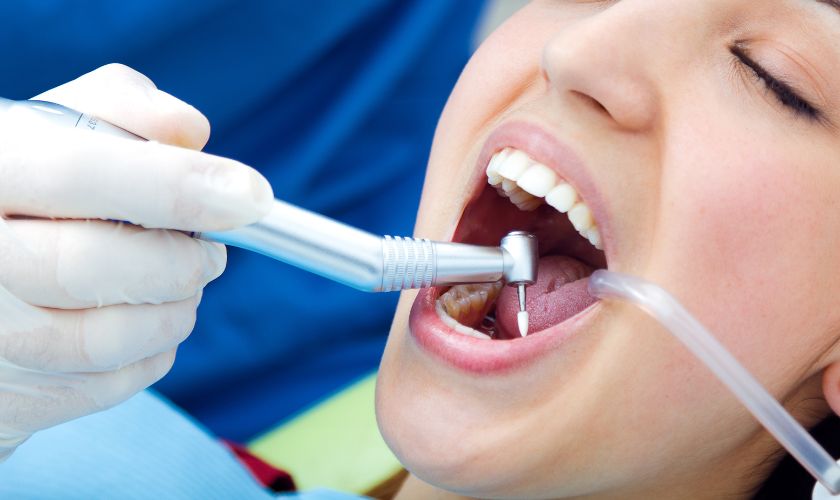 Dental Implants in Scottsdale Dental Implants in Scottsdale