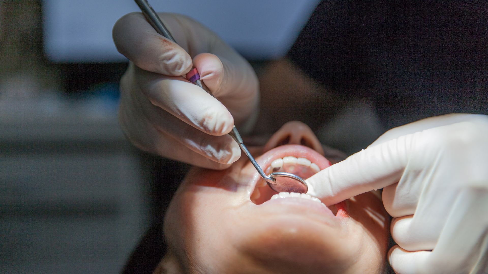 Oral Cancer Scottsdale Oral Cancer Scottsdale