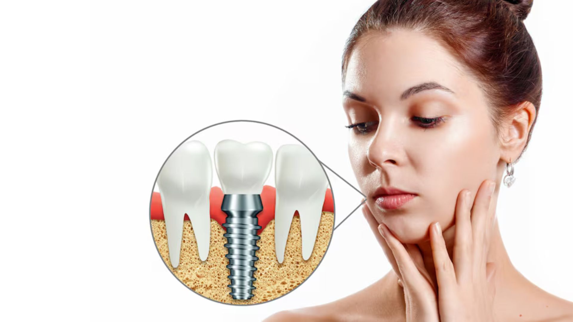 Painless Dental Implant Solutions in Scottsdale