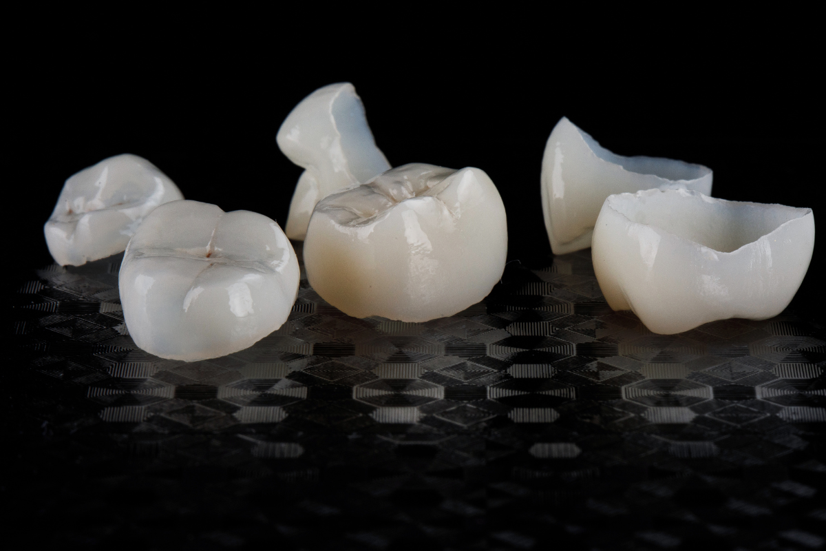 Are Our Dental Crowns in Scottsdale Stronger Than Real Teeth?