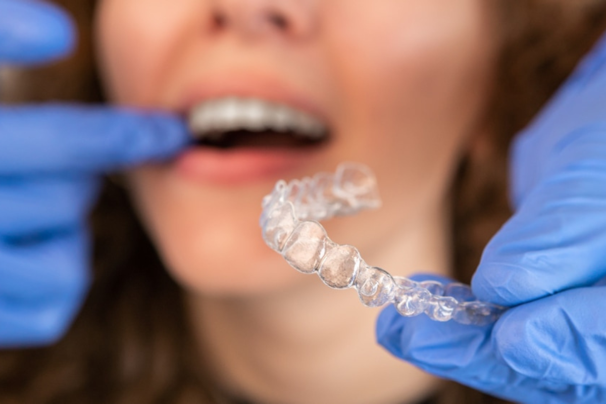 How Long Does Invisalign Take to Work? Timeline Explained by our Scottsdale Expert