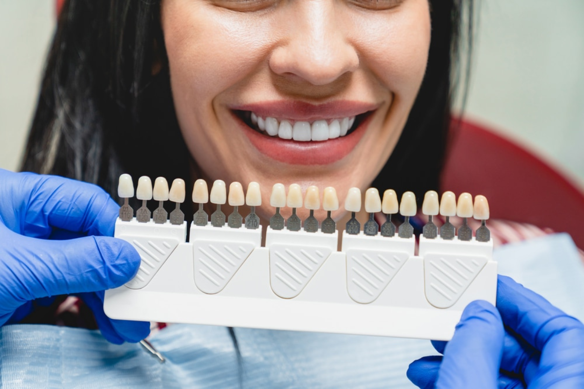 Do Veneers Damage Your Teeth? Know from Our Cosmetic Dentist in Scottsdale, AZ Do Veneers Damage Your Teeth? Know from Our Cosmetic Dentist in Scottsdale, AZ