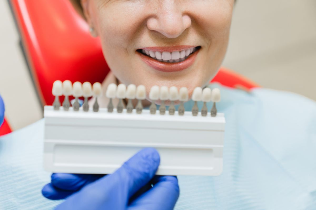 can-i-get-porcelain-veneers-if-i-grind-my-teeth