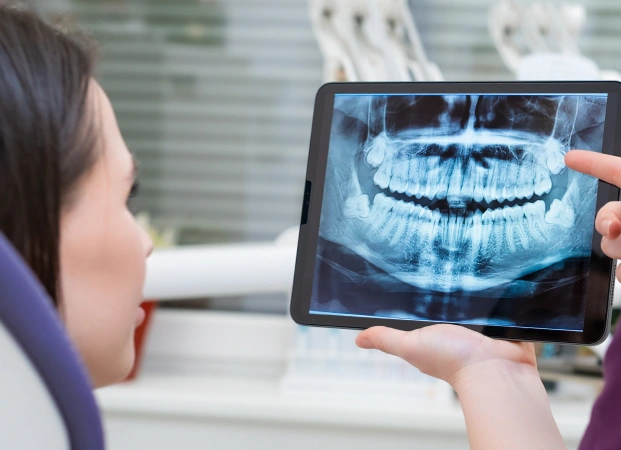 Digital X-Rays